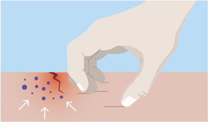 Scratching illustration